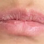 Backgrounds of Dry lips in the clinic.